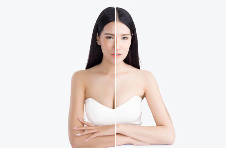 diy skin whiting 1 720x471 - 10 Best DIY Natural Face Whitening Cream